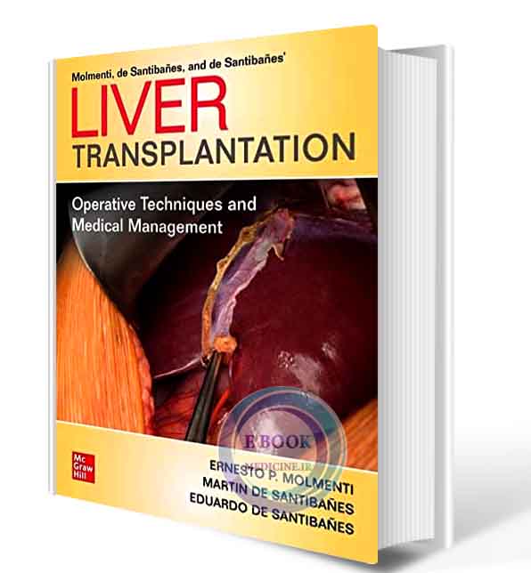 دانلود کتاب Liver Transplantation: Operative Techniques and Medical Management  2021 (ORIGINAL PDF) 